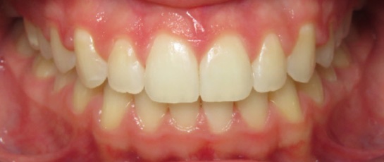 after image