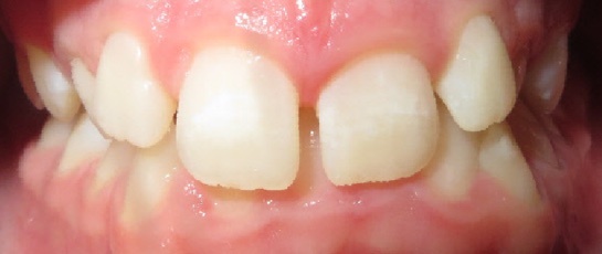 before image