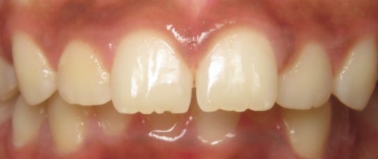 before image